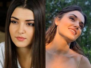 Hande Erçel Before and After Plastic Surgery
