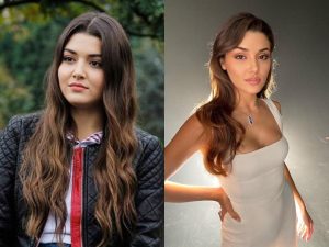 Hande Erçel before and after plastic surgery